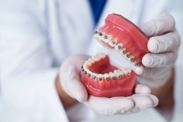 A Healthier Smile Starts With Personalized Orthodontic Care